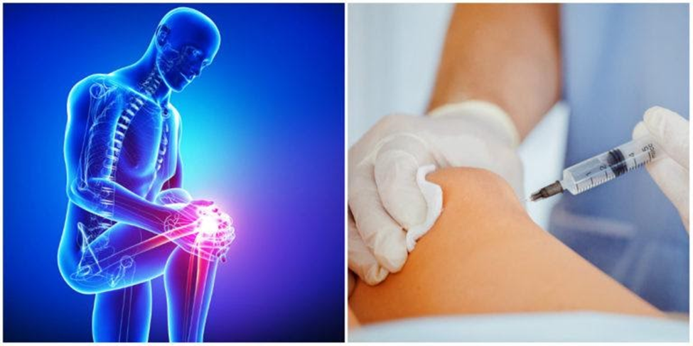 Stem Cell Therapy  Cellular Injections for Chronic Joint Pain