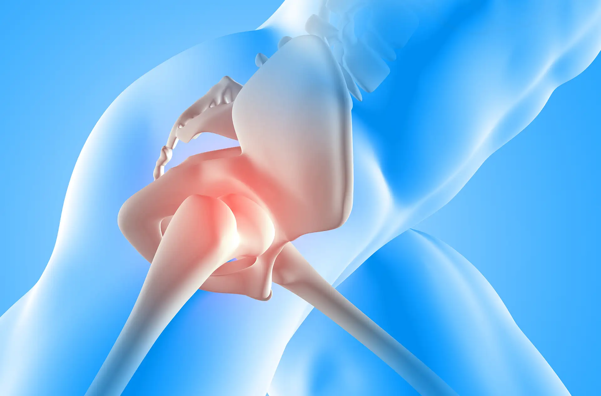 Hip Conditions