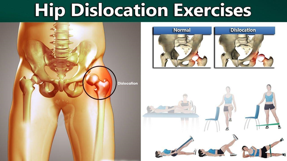 Exercises for your hip