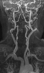 MRA imaging exam