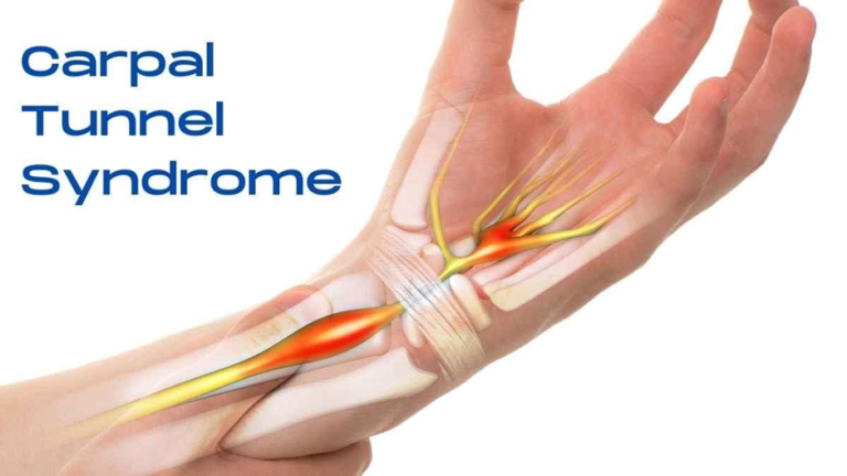 Carpal Tunnel Release