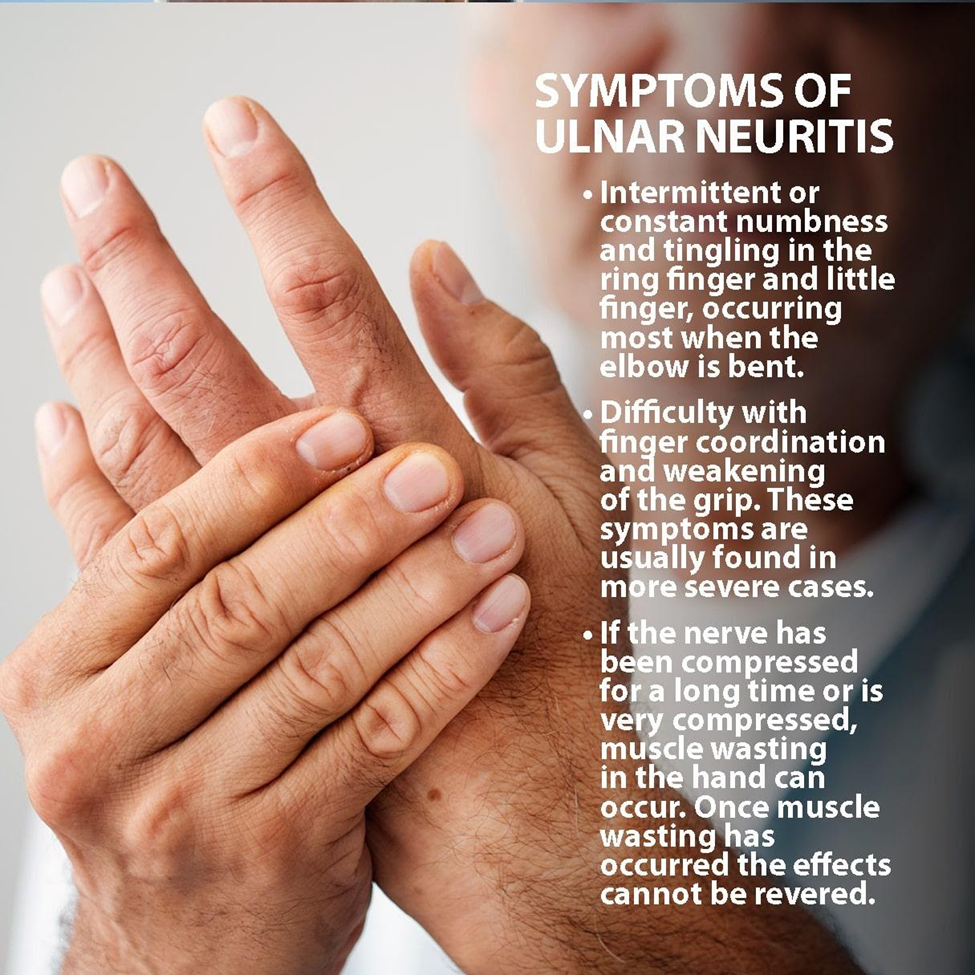 Common Symptoms of Ulnar Nerve