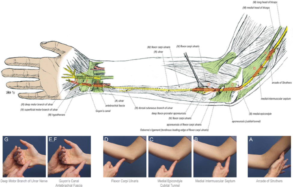 The Transposition of the Ulnar Nerve