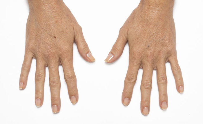 After Hand