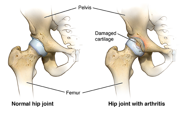 Hip Anatomy