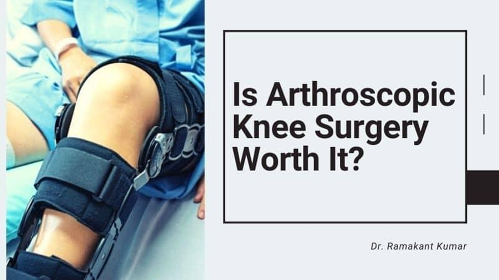 Is Arthroscopic Knee Surgery worth it?