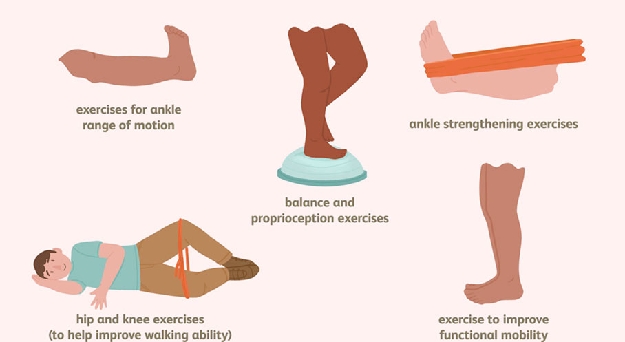 Post-Operative Care (Recovery) of Ankle Fracture Surgery