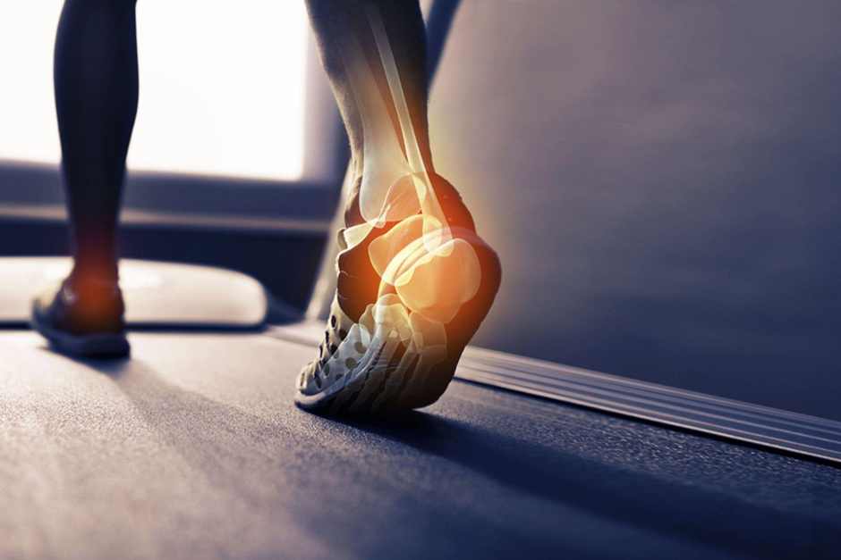Ankle Arthroscopy