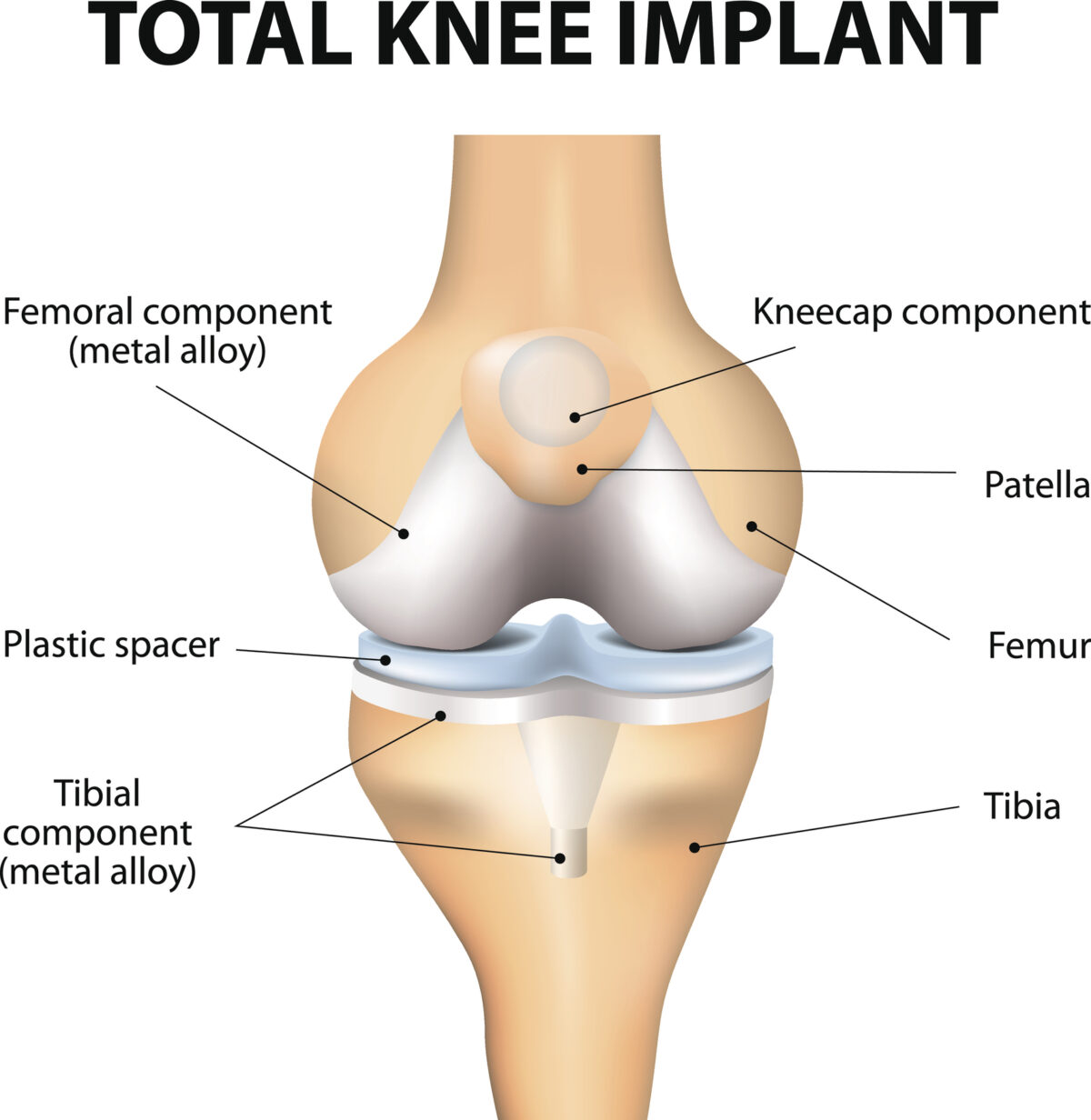 Anatomical Graphic of the Knee