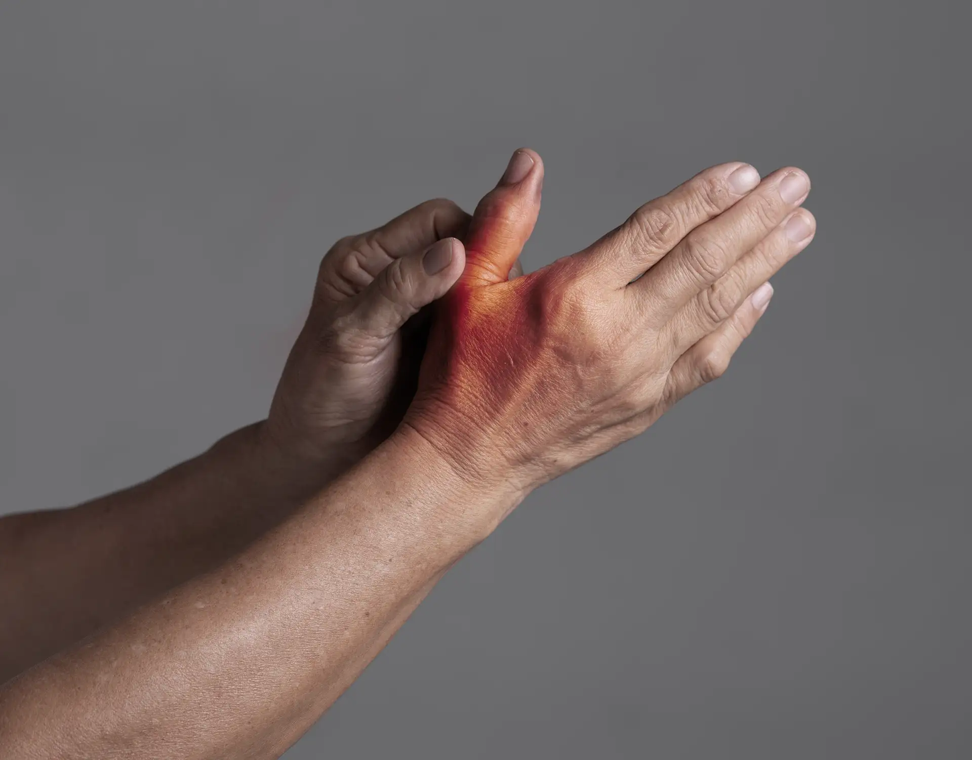 Dr. Sforzo’s Post-Operative Instructions for Thumb Arthritis Surgery