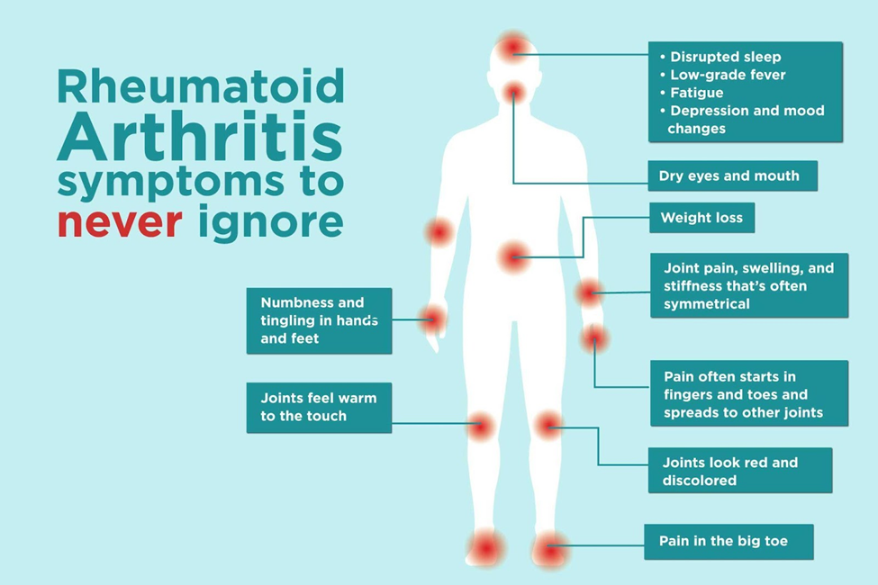 Anatomical graphic of Rheumatoid Arthritis symptoms to never ignore