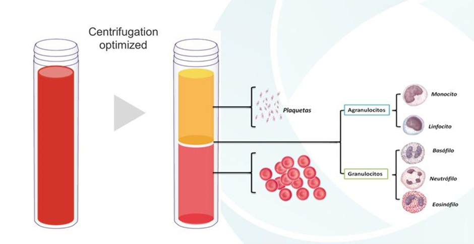 Graphic of process for PRP treatment