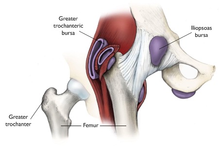 Anatomical graphic of greater trochanteric bursa