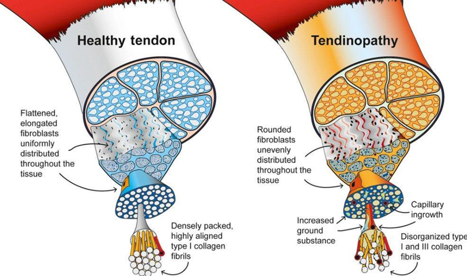 Inside what PRP does in the elbow