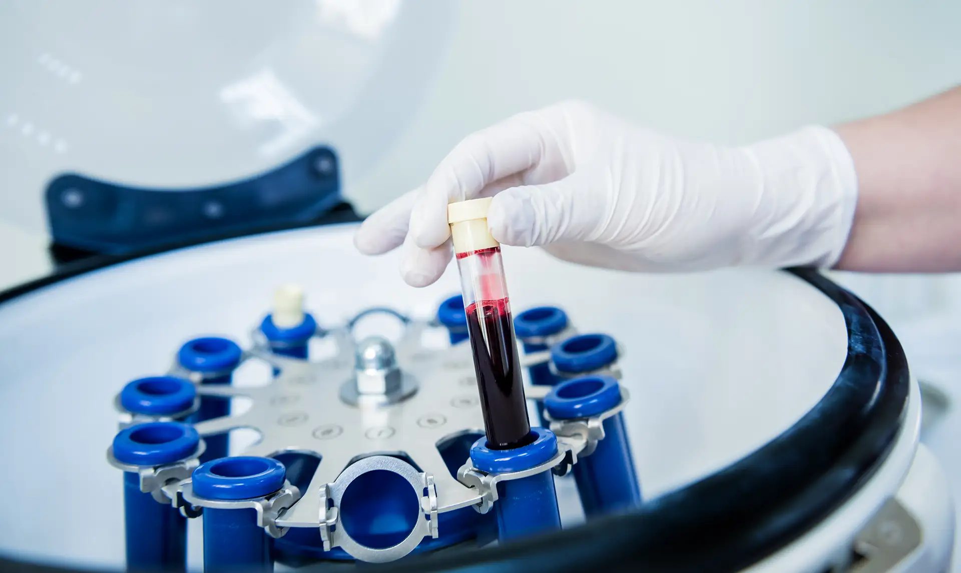 Platelet-Rich Plasma