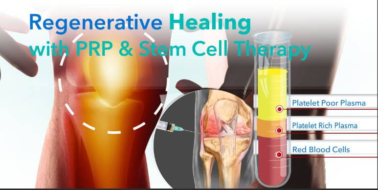 Regenerative Healing with PRP & Stem Cell Therapy