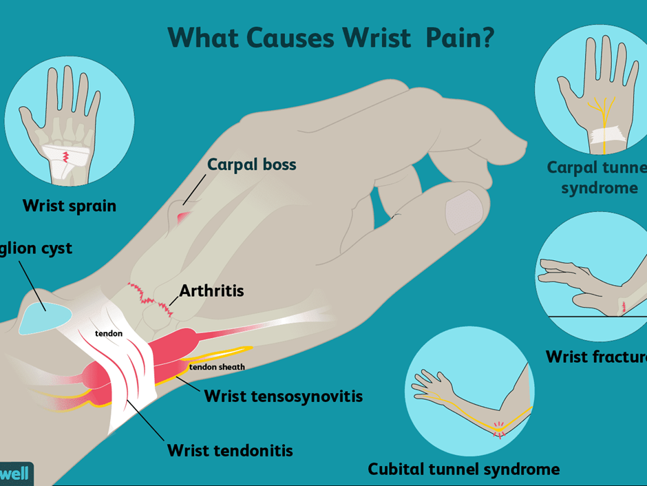 What causes wrist pain