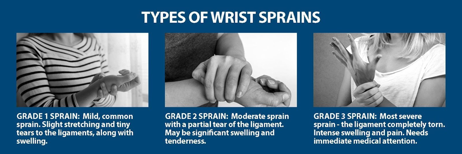 Types of wrist sprains