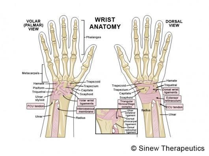 Anatomical graphic wrist sprain anatomy