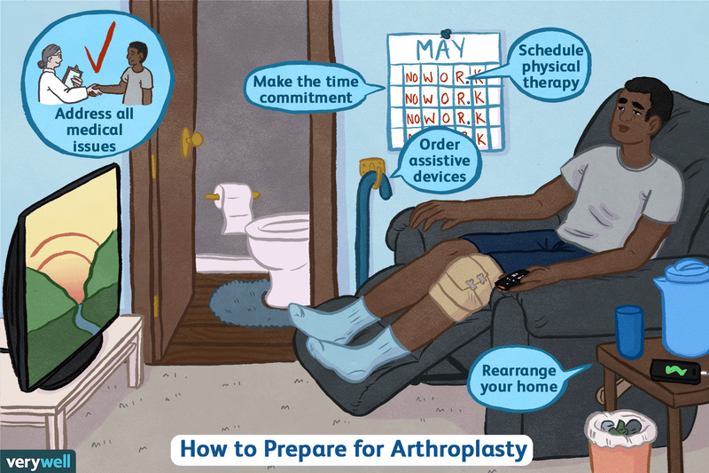 
How To Prepare For Arthroplasty?
